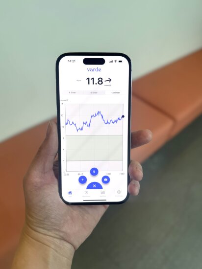 En hånd holder en mobiltelefon. På skjermen vises en hakkete, blå linje som går litt opp og ned.